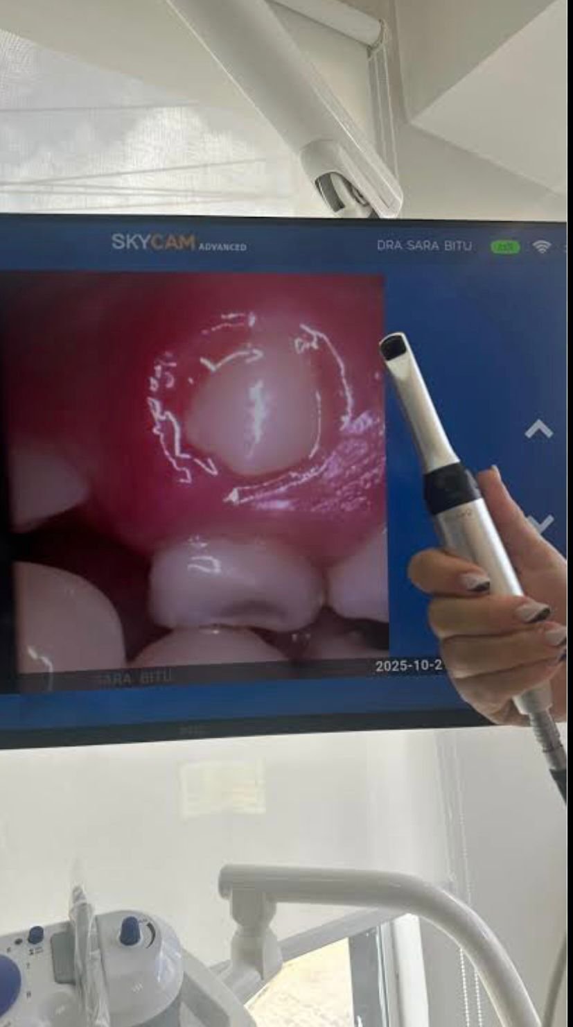 Câmera intraoral em uso na clínica Leende